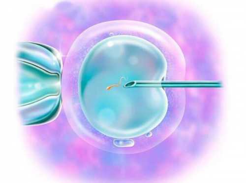 45岁取卵后遗症与供卵代怀成功率解析