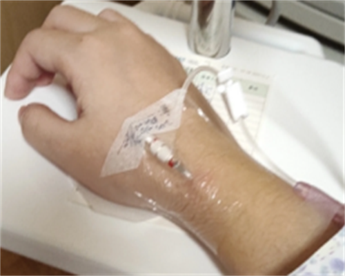 湛江三代试管婴儿生孩子的费用明细与医院推荐指南