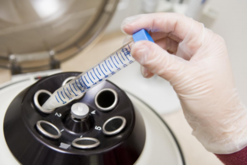 江苏借卵试管婴儿生男孩医院排名与成功率解析