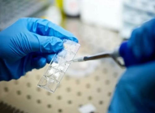 28岁卵巢早衰女性试管助孕费用解析与高成功率方案